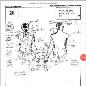 gigi autopsy sketch|Kobe Bryant Autopsy Report